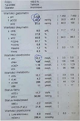 Sudden Cardiac Arrest in a Patient With COVID-19 as a Result of Severe Hyperkalemia After Administration of Succinylcholine Chloride for Reintubation. A Case Report